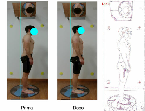 Perchè è indispensabile un trattamento di riequilibrio posturale prima di un bike fitting?
